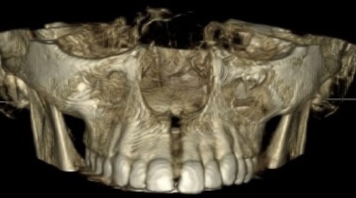 La revista Scientific Journal BMC Oral Health publica un article de l’estudi realitzat pel Sr. Sanchez Riofrío