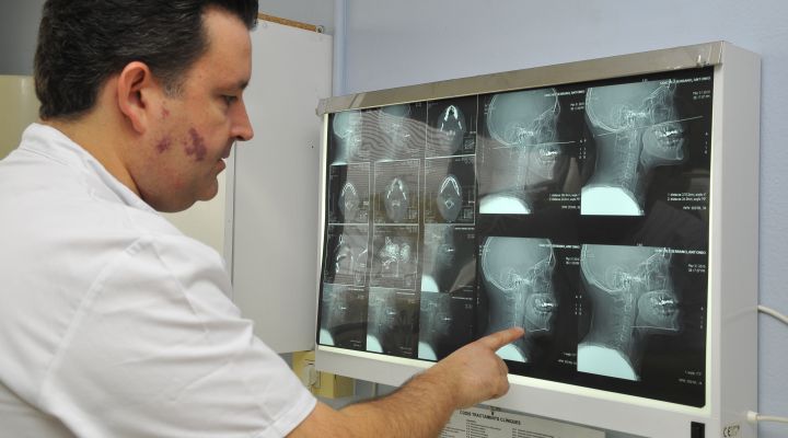 Trastornos de la articulación temporomandibular (ATM)